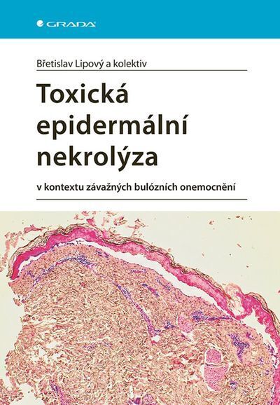 Toxická epidermální nekrolýza (e-kniha)