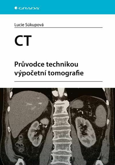 CT - Průvodce technikou výpočetní tomografie (e-kniha)