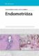 Endometrióza (e-kniha)