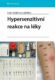 Hypersenzitivní reakce na léky (e-kniha)