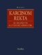 Karcinom rekta (e-kniha)