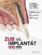 Zub vs. implantát (e-kniha)