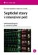 Septické stavy v intenzivní péči (e-kniha)