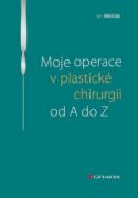 Moje operace v plastické chirurgii od A do Z (e-kniha)