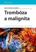 Trombóza a malignita (e-kniha)