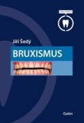 Bruxismus (e-kniha)
