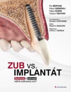 Zub vs. implantát (e-kniha)