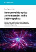 Neuromyelitis optica a onemocnění jejího širšího spektra (e-kniha)